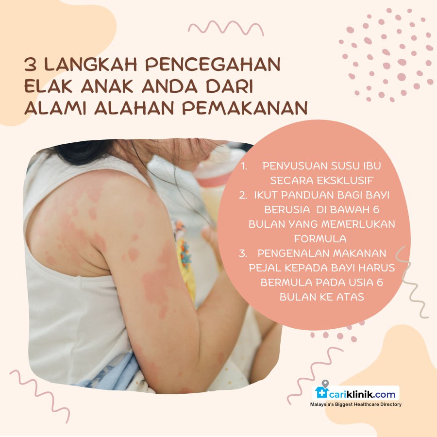 3 LANGKAH ELAK PENCEGAHAN ANAK ANDA DARI ALAMI ALAHAN PEMAKANAN