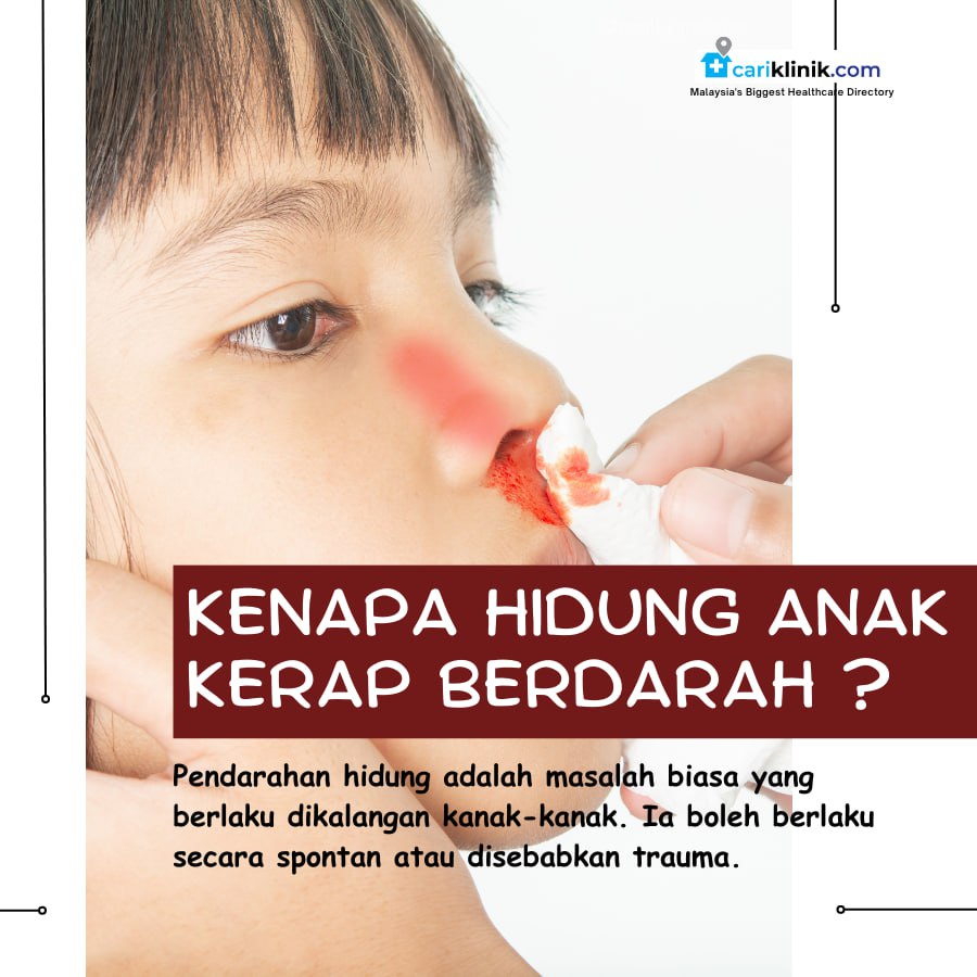 KENAPA HIDUNG ANAK KERAP BERDARAH ?