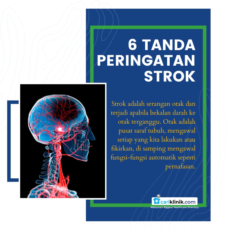 6 TANDA PERINGATAN STROK YANG TIDAK BOLEH DIABAIKAN