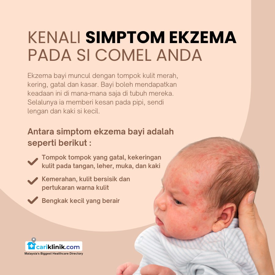 KENALI SIMPTOM EKZEMA PADA SI COMEL ANDA