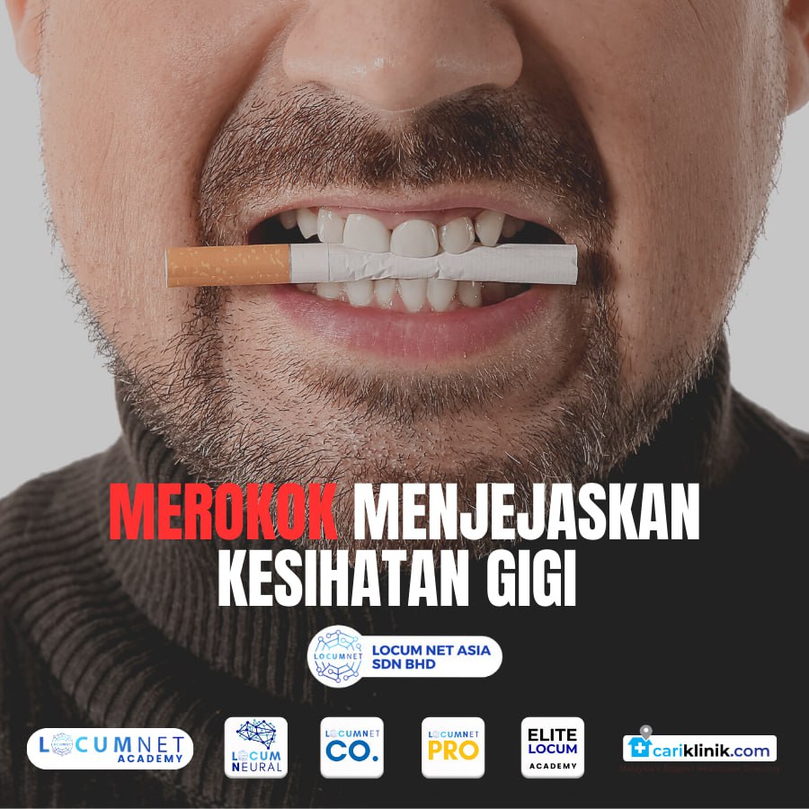 MEROKOK MENEJASKAN KESIHATAN GIGI