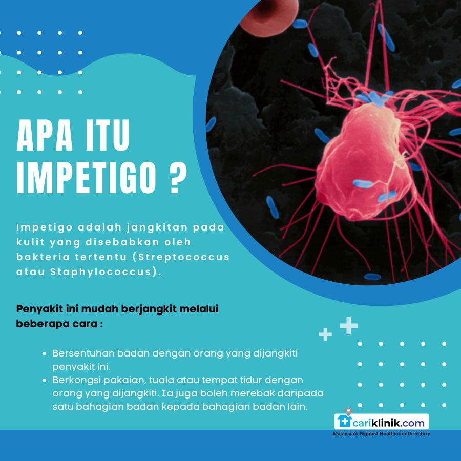 IMPETIGO PADA ANAK, BAGAIMANA IANYA BOLEH BERLAKU ?