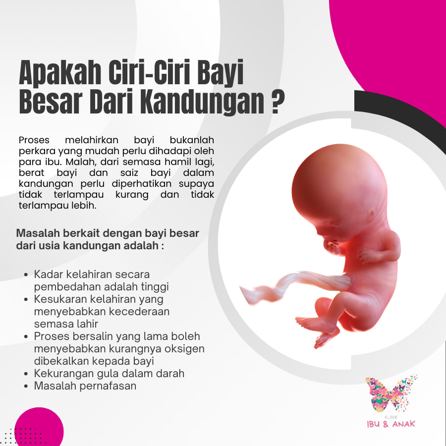 Apakah Ciri-Ciri Bayi Besar Dari Kandungan?