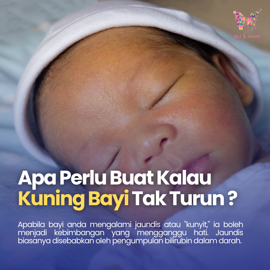Apa Perlu Buat Kalau Bayi Kuning Tak Turun-Turun ?
