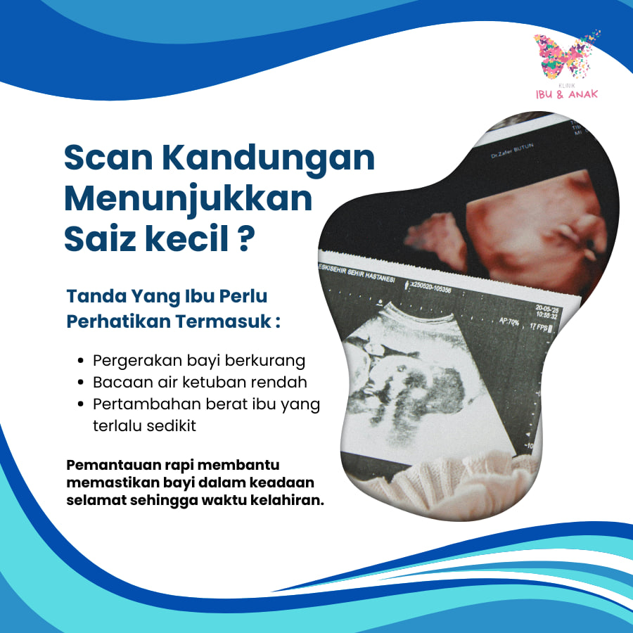 Scan Kandungan Menunjukkan Saiz Kecil
