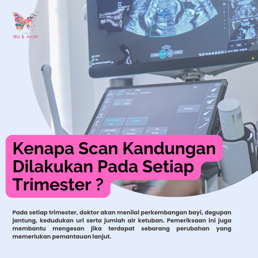 Kenapa Scan Kandungan Dilakukan Setiap Trimester