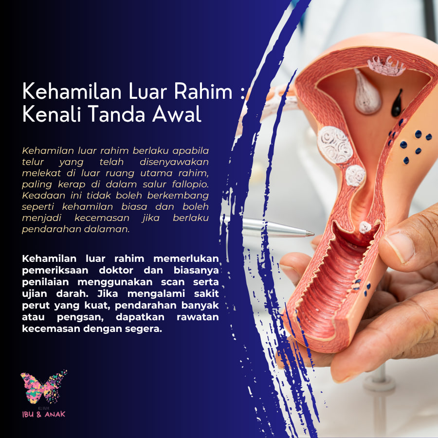 Kehamilan Luar Rahim : Kenali Tanda Awal