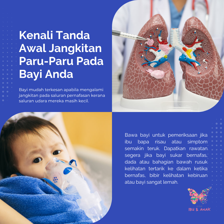 KENALI TANDA AWAL JANGKITAN PARU-PARU PADA BAYI ANDA