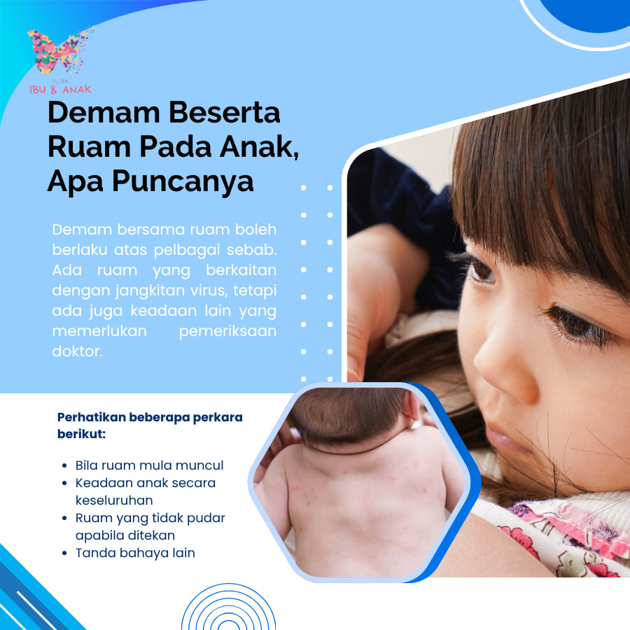 DEMAM BESERTA RUAM PADA ANAK, APA PUNCANYA